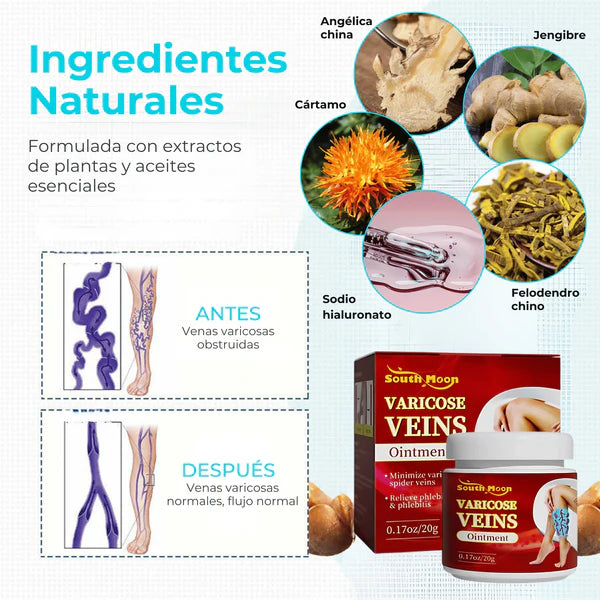 Crema Varicose Veins - Tratamiento de varices y arañitas, Resultados en 2 semanas