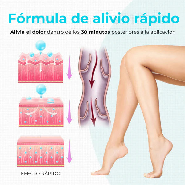 Crema Varicose Veins - Tratamiento de varices y arañitas, Resultados en 2 semanas