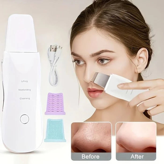 Peeling ultrasónico Sonic Skin Ionización Limpiador facial antiarrugas